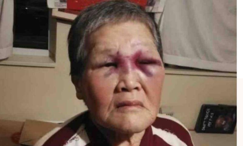 76岁华裔老太街头反抗白人袭击2万美国网友给捐款治伤
